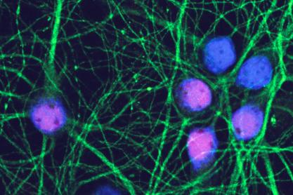 Red and blue dots, neurons, surrounded by bright green stringy lines