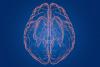 UVA Reveals True Nature of Cells Blamed in Alzheimer's