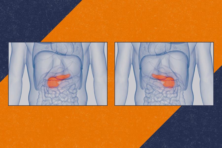 illustration of two human body diagrams showing the pancreas
