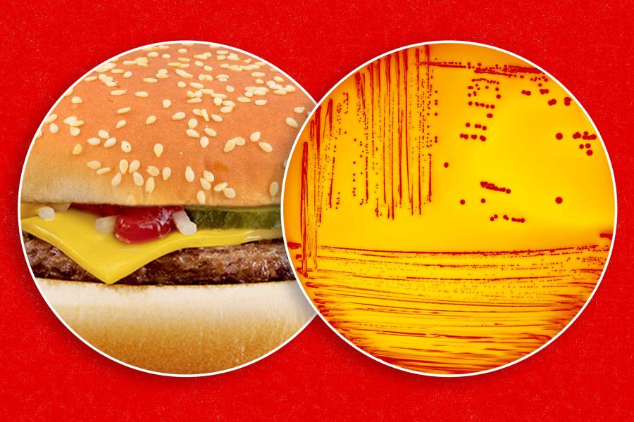 A collage of a McDonalds burger and a close up microscope view of e. coli