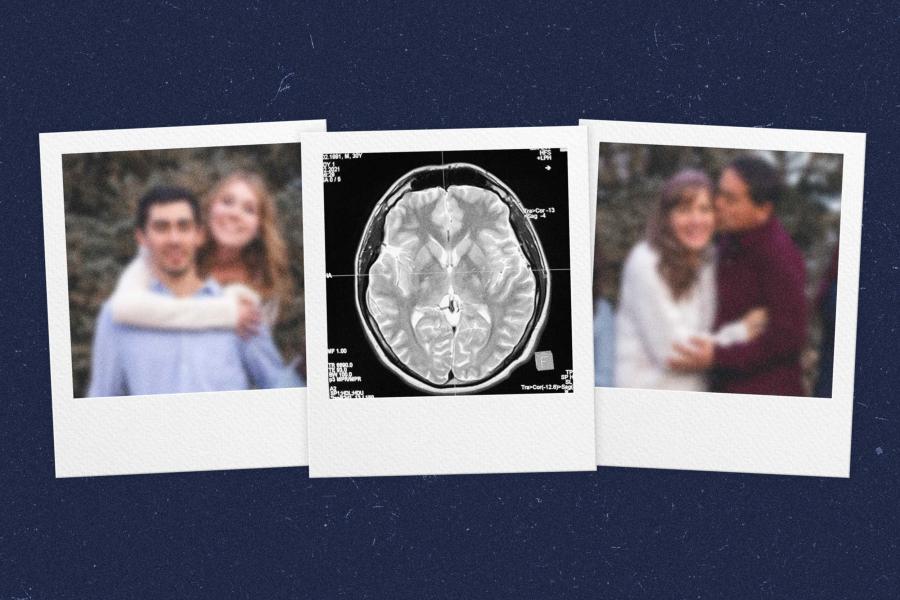 illustration of 3 instant camera photographs depicting an MRI scan of a brain flanked by two blurry photos of couples