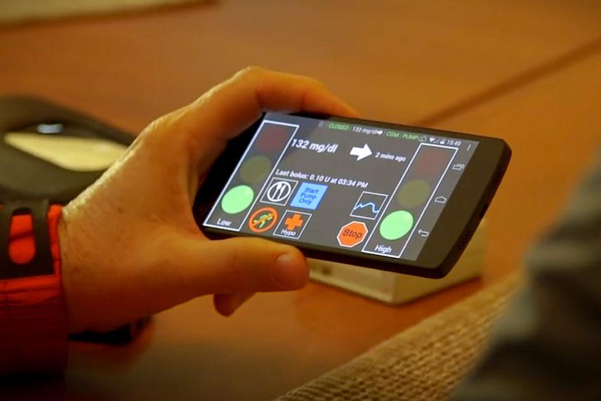The artificial pancreas system, developed at UVA, uses smartphone technology to monitor and stabilize insulin levels.