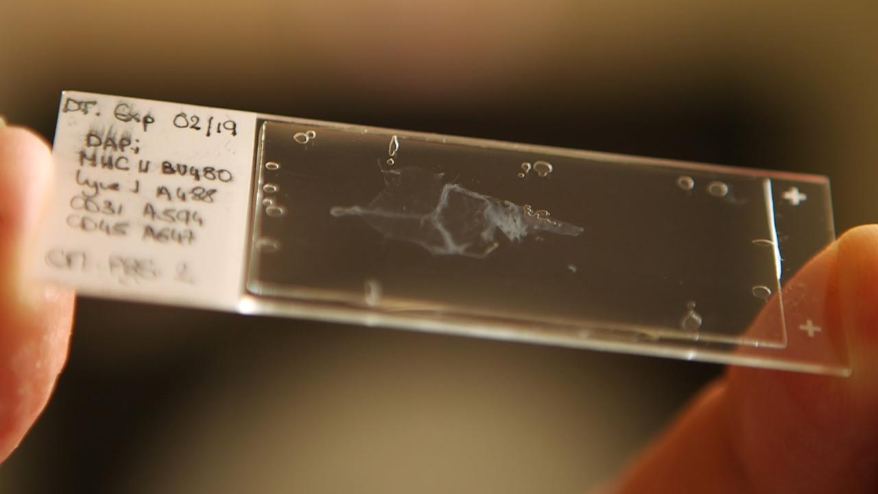  smear on a microscope slide