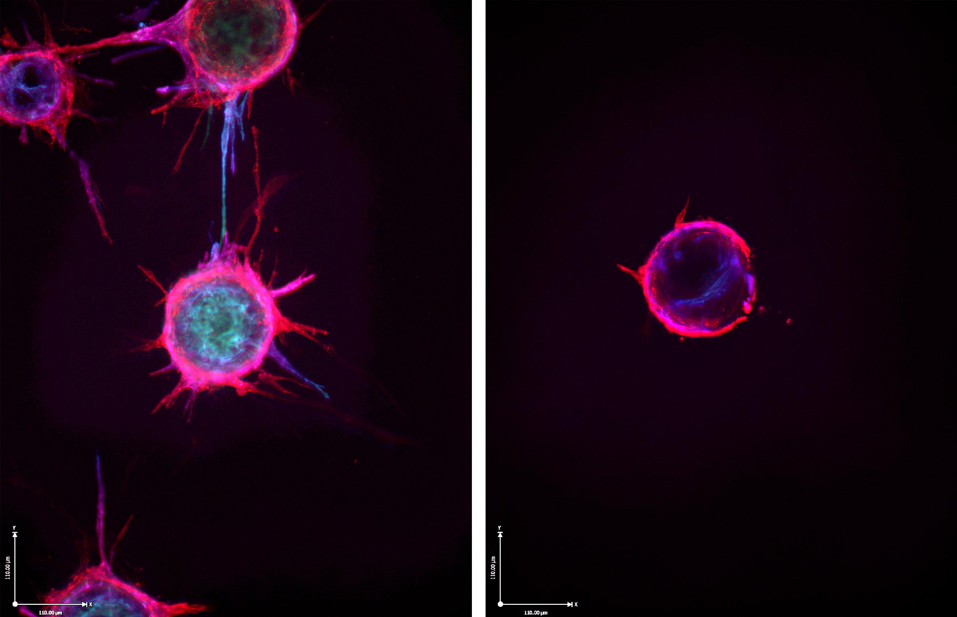 left: depicts blood vessel budding. Right: shows the lack of budding after treatment with microRNA